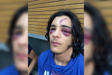 Quand les policiers c&eacute;l&egrave;brent la victoire des bleus &agrave; coups de flashball